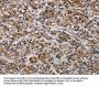 PLIN3 Antibody