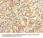 FCGR2A Antibody