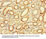 FCGR2A Antibody