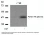 Phospho-KRT18 (Ser33) Antibody
