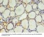 EFCAB14 Antibody