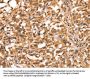 ACADVL Antibody