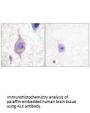 ALK Antibody