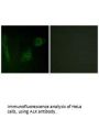 ALK Antibody