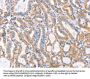 F13A1 Antibody