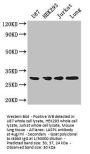 LASP1 Antibody