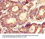 LASP1 Antibody