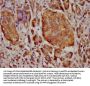 MT3 Antibody