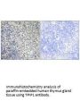 TP53AIP1 Antibody
