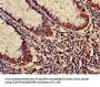 KARS Antibody