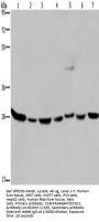 ECHS1 Antibody