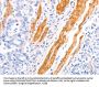 TPM1 Antibody