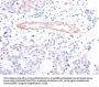 TPM1 Antibody