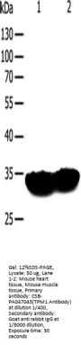 TPM1 Antibody