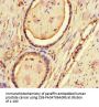 CFL1 Antibody