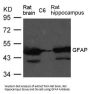 GFAP Antibody