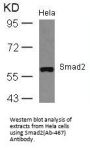 SMAD2 (Ab-467) Antibody