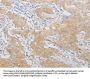 PDE4D Antibody