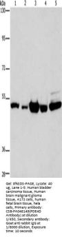 PDE4D Antibody