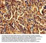 PDCD6 Antibody