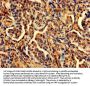PDCD6 Antibody
