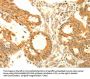 SOCS6 Antibody