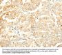 SOCS6 Antibody