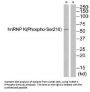 Phospho-HNRNPK (Ser216) Antibody