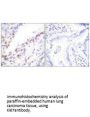 MKI67 Antibody