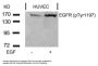 Phospho-EGFR (Tyr1197) Antibody