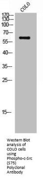 Phospho-SRC (S75) Antibody