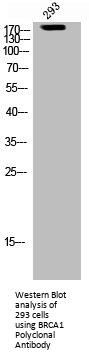 BRCA1 Antibody