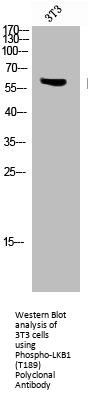 Phospho-STK11 (T189) Antibody