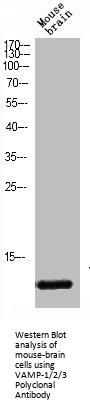 VAMP1/VAMP2/VAMP3 Antibody