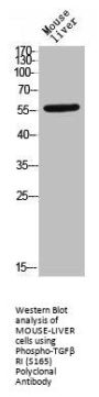 Phospho-TGFBR1 (S165) Antibody