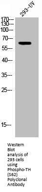 Phospho-TH (S62) Antibody