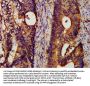 HSPA5 Antibody