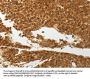 SOCS7 Antibody