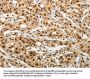 SOCS7 Antibody