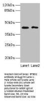 BTBD2 Antibody