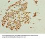 BTBD2 Antibody