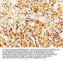 TLN1 Antibody