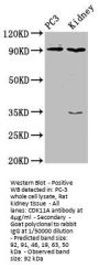 CDK11A Antibody