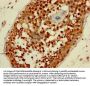 AATF Antibody
