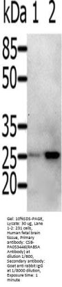 RAB5A Antibody
