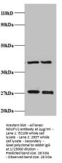 NDUFV2 Antibody