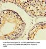 CTDNEP1 Antibody