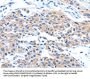 ARL11 Antibody