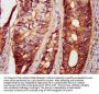PAK4 Antibody