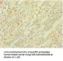 PICK1 Antibody